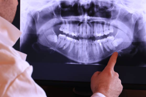 Best Urgent Dental Care for Toothache in Calverton, MD