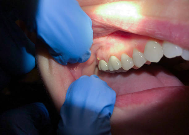 Best Orthodontic Emergency Dentist in Calverton, MD